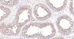 GSK3 alpha Antibody in Immunohistochemistry (Paraffin) (IHC (P))