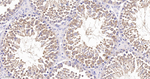GSK3 alpha Antibody in Immunohistochemistry (Paraffin) (IHC (P))