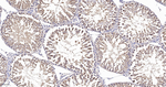 GSK3 alpha Antibody in Immunohistochemistry (Paraffin) (IHC (P))