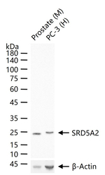 SRD5A2 Recombinant Rabbit Monoclonal Antibody (5H4)