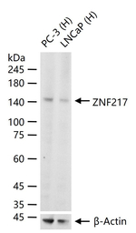 ZNF217 Recombinant Rabbit Monoclonal Antibody (5C8)