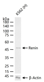 Renin Recombinant Rabbit Monoclonal Antibody (3A11)