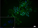 CLPP Recombinant Rabbit Monoclonal Antibody (12G6)