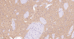 CLPP Antibody in Immunohistochemistry (Paraffin) (IHC (P))