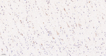 CLPP Antibody in Immunohistochemistry (Paraffin) (IHC (P))