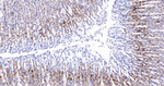 CLPP Antibody in Immunohistochemistry (Paraffin) (IHC (P))