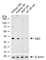 ABO Recombinant Rabbit Monoclonal Antibody (7G5)