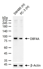 ASK Recombinant Rabbit Monoclonal Antibody (2B5)