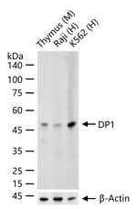 DP1 Recombinant Rabbit Monoclonal Antibody (7C3)