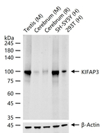 KAP3 Recombinant Rabbit Monoclonal Antibody (9G2)