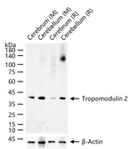 TMOD2 Antibody in Western Blot (WB)