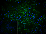 DLD Recombinant Rabbit Monoclonal Antibody (12C9)