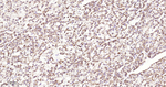 DLD Antibody in Immunohistochemistry (Paraffin) (IHC (P))
