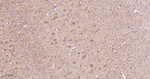 DLD Antibody in Immunohistochemistry (Paraffin) (IHC (P))