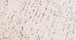 DLD Antibody in Immunohistochemistry (Paraffin) (IHC (P))