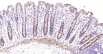 DLD Antibody in Immunohistochemistry (Paraffin) (IHC (P))