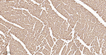 DLD Antibody in Immunohistochemistry (Paraffin) (IHC (P))