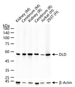 DLD Antibody in Western Blot (WB)