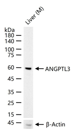 ANGPTL3 Recombinant Rabbit Monoclonal Antibody (9E2)