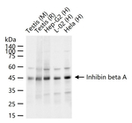 Activin A Recombinant Rabbit Monoclonal Antibody (5H1)