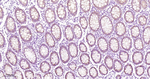FABP2 Antibody in Immunohistochemistry (Paraffin) (IHC (P))