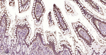 FABP2 Antibody in Immunohistochemistry (Paraffin) (IHC (P))