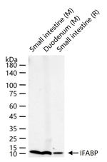 FABP2 Antibody in Western Blot (WB)