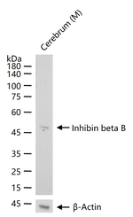 INHBB Recombinant Rabbit Monoclonal Antibody (5F13)
