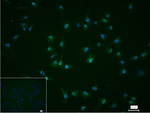Arp2 Recombinant Rabbit Monoclonal Antibody (11H4)