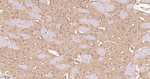 Arp2 Antibody in Immunohistochemistry (Paraffin) (IHC (P))
