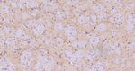 Arp2 Antibody in Immunohistochemistry (Paraffin) (IHC (P))