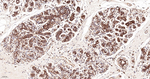 Arp2 Antibody in Immunohistochemistry (Paraffin) (IHC (P))
