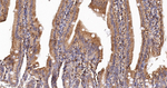 Arp2 Antibody in Immunohistochemistry (Paraffin) (IHC (P))