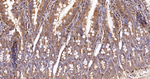 Arp2 Antibody in Immunohistochemistry (Paraffin) (IHC (P))