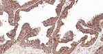 Arp2 Antibody in Immunohistochemistry (Paraffin) (IHC (P))
