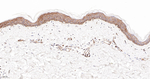 Arp2 Antibody in Immunohistochemistry (Paraffin) (IHC (P))