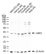 Arp2 Antibody in Western Blot (WB)