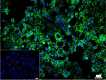FXR1 Recombinant Rabbit Monoclonal Antibody (9D20)