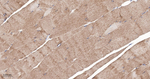 FXR1 Antibody in Immunohistochemistry (Paraffin) (IHC (P))