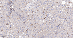 FXR1 Antibody in Immunohistochemistry (Paraffin) (IHC (P))