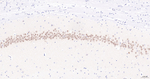 TCF4 Antibody in Immunohistochemistry (Paraffin) (IHC (P))