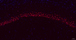 TCF4 Antibody in Immunohistochemistry (Paraffin) (IHC (P))