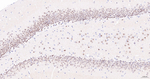 TCF4 Antibody in Immunohistochemistry (Paraffin) (IHC (P))