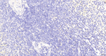 TCF4 Antibody in Immunohistochemistry (Paraffin) (IHC (P))