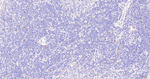 TCF4 Antibody in Immunohistochemistry (Paraffin) (IHC (P))