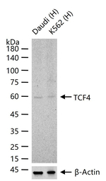 TCF4 Antibody in Western Blot (WB)