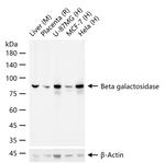 beta Galactosidase Recombinant Rabbit Monoclonal Antibody (10A12)