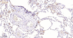 ARHGAP5 Antibody in Immunohistochemistry (Paraffin) (IHC (P))