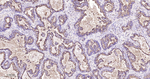 ARHGAP5 Recombinant Rabbit Monoclonal Antibody (4E6)