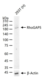 ARHGAP5 Antibody in Western Blot (WB)
